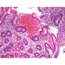 HEMATOXILINA SEG. MAYER P/ MICROSCOPIA MERCK (FRASCO 2,5L)